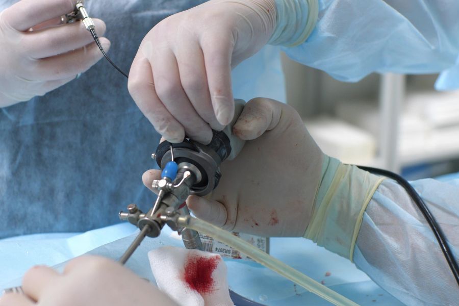 Principais vantagens da Cirurgia Endoscópica